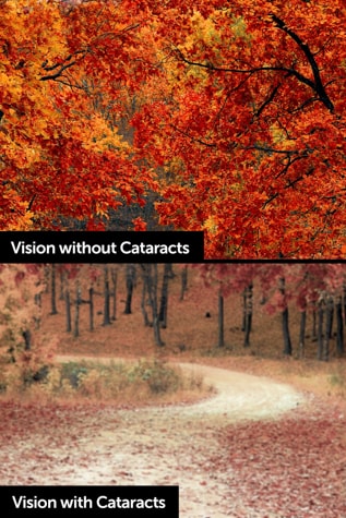 What patients see with cataracts: blurry, dull, desaturated vision.